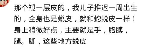 猫小鱼|为啥生孩子不能超过预产期？医生打开子宫感叹，说亏着你坚持剖