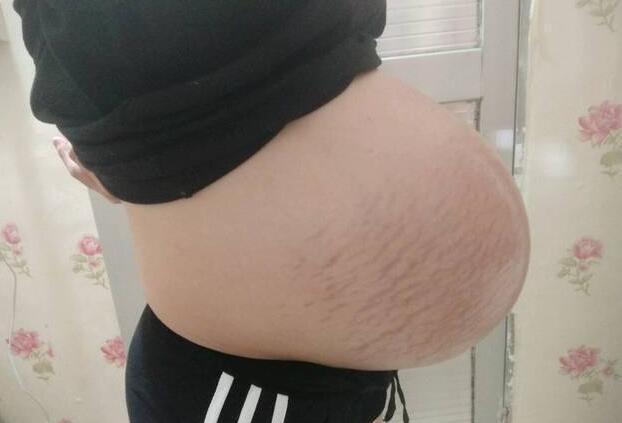 纯美小青年|“悬浮肚”的孕妈身材好？被羡慕的背后，几个问题接踵而至