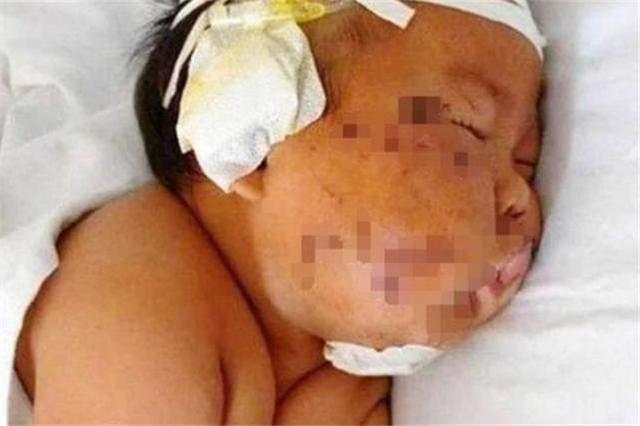 幸福大联盟|因吃奶太用力，男婴被宝妈刮花脸，如今真相大白网友心疼宝妈