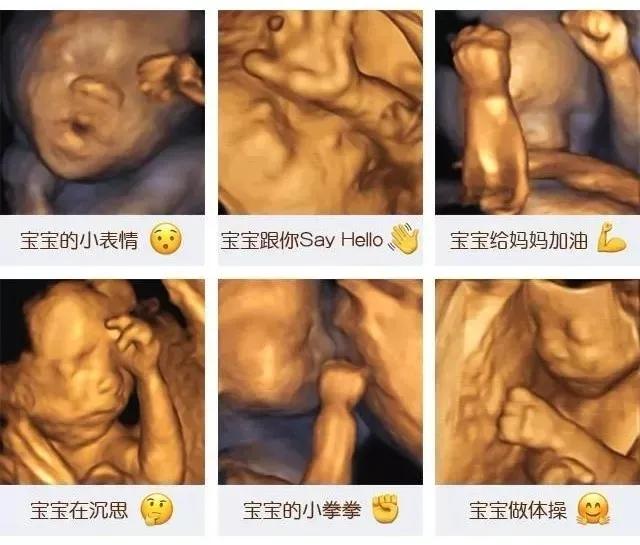 「你的育儿经」为什么E10四维彩超受到更多妈妈青睐？看完就知道了