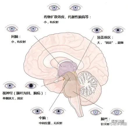 WoW，最全神经系统解剖图来了