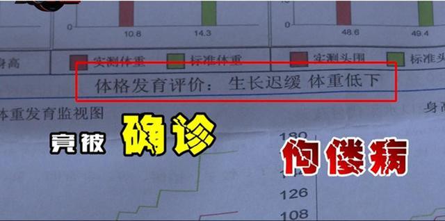【超级宝妈】商家居然将固体饮料当奶粉卖，致多名幼儿喝成“大头娃娃”