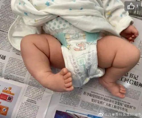 小酒窝|每年都有一些父母，因不知道这个疾病可治愈，而放弃胎儿生命