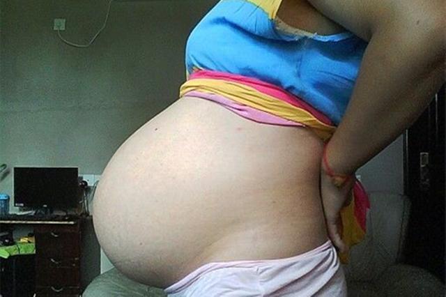 超级宝妈|孕妇“悬浮肚”是咋回事？跟多胞胎关系不大，可能是“头盆不称”