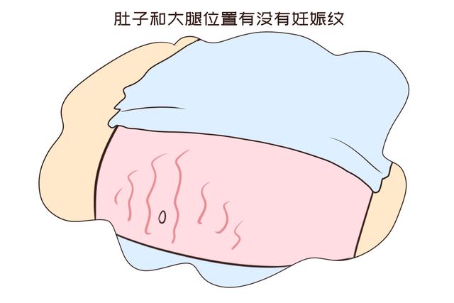 #超级宝妈#怀孕时老婆说是头胎，母亲说不是第一胎，从这些方面能看出