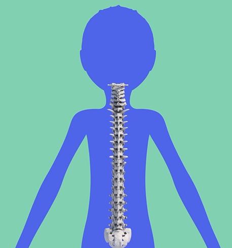 健康学堂|孩子高低肩，可能是病，这些脊柱侧凸自查方法，家长们一定要收藏