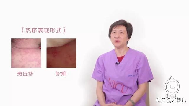 「超级宝妈」天热痱子找上门，宝宝该如何是好？