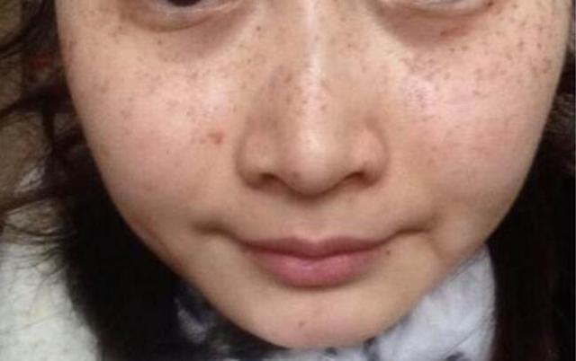 温柔大叔|怀孕后的皮肤状态能预示胎儿性别?科学真相在这里,别再偏听偏信