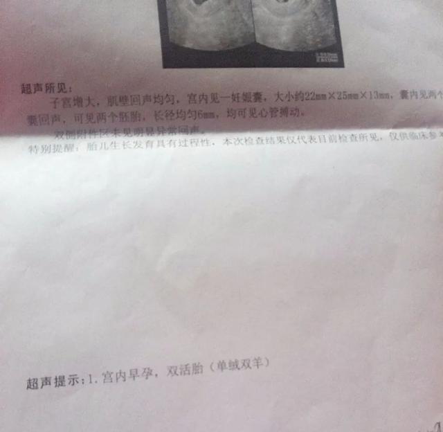 #你的育儿经#浙江男子带老婆做孕检,一查肚子里竟有4个...网友算了笔帐,一般人真不知道