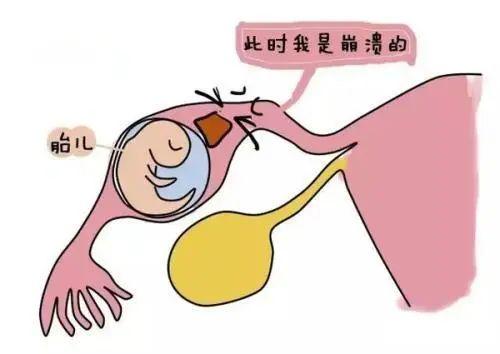 『超级宝妈』世界无烟日 |“孕卵”出走，烟雾竟是幕后黑手