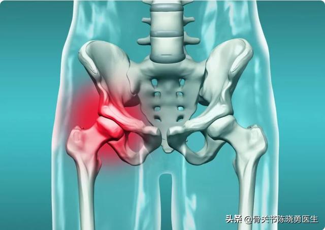 [你的育儿经]孕妇常见的6种骨关节疾病