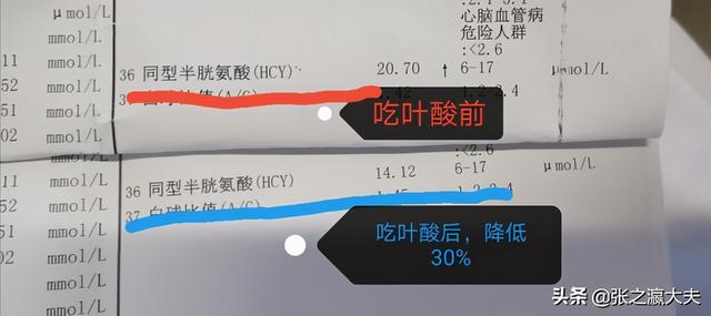 中国脑梗塞病人多，医生说：因为很多高血压病人，缺乏这种物质