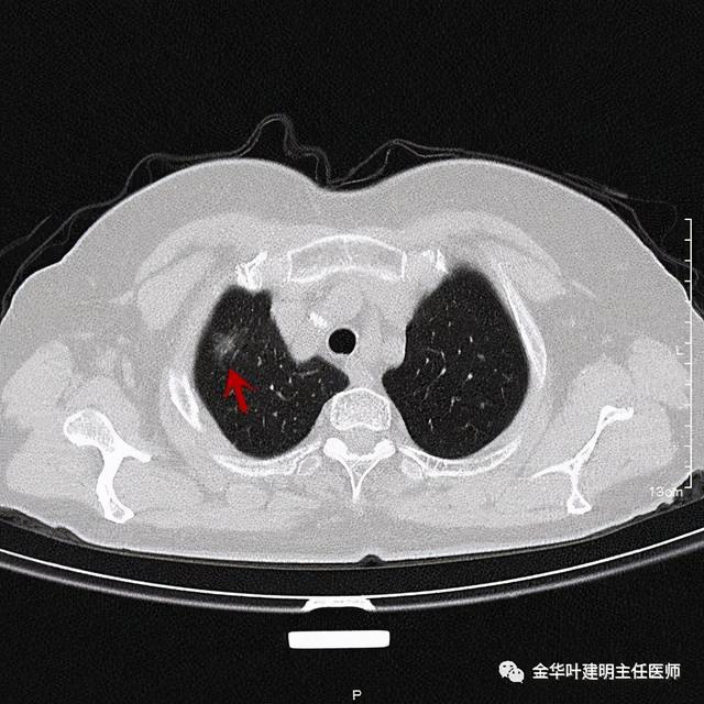 如此违反原则的手术方案设计，你支持吗？