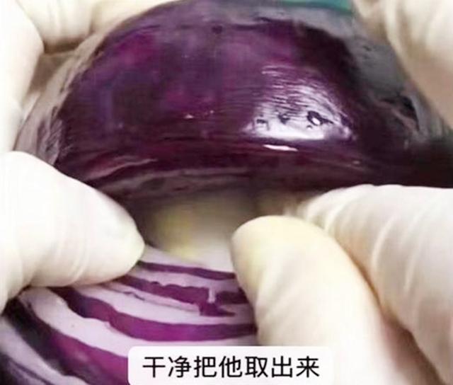 你的育儿经|选剖腹产不疼？这根10厘米的麻醉针仅仅是开始，疼到你怀疑人生