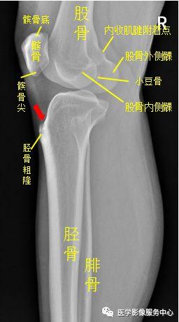 独立值班了 这些骨折你都看出来了吗（附注解）