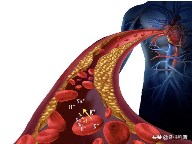 入院重点保护对象：68岁阿叔脊柱化脓了还合并有电解质紊乱（下）