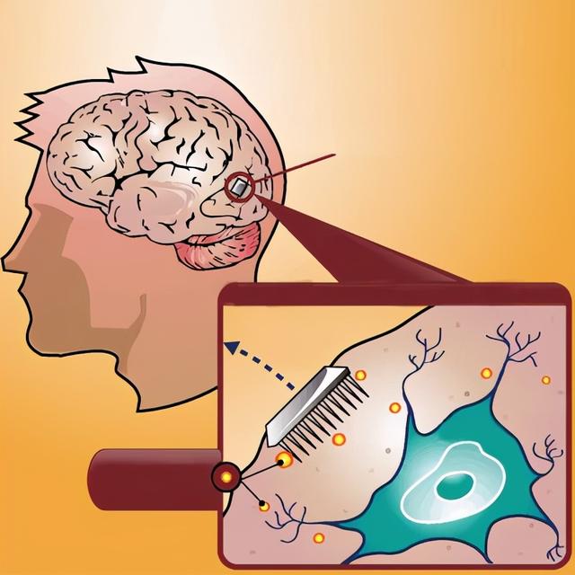 发展大势！脑机互联让“脑控”不再遥远