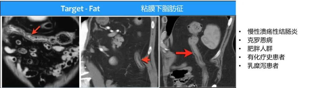 什么是 CT 增强？强化程度、模式、扫描时相等问题逐一解答