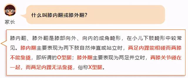 X型腿、O型腿，尽早矫正还来得及