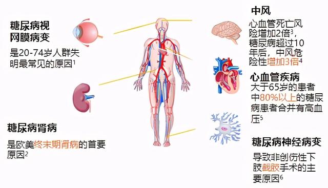 糖尿病，究竟可不可怕？这回专家给你讲清楚