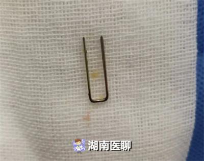 你的育儿经■男童误抠气枪扳机，竟致铁钉穿耳！家有“神兽”您需Get这些知识
