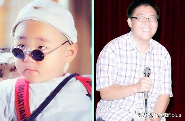 你的育儿经■这4种娃越长越难看，长大也难逃“变丑”结果，快看有你家娃没