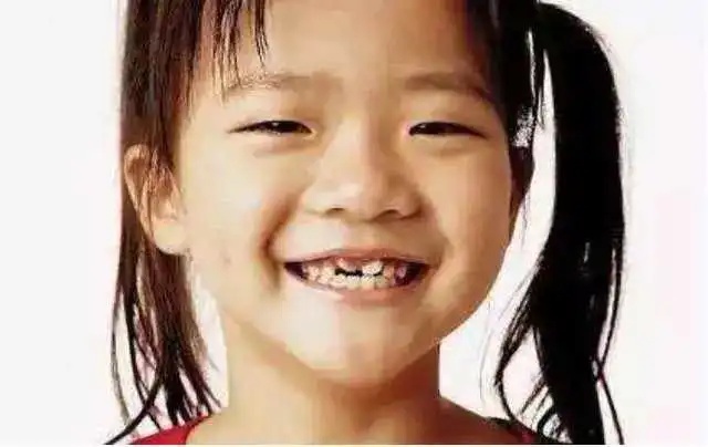 优雅的叶子|牙医拔牙到手软：每天接诊20个双排牙孩子，请家长先停止“宠溺”！
