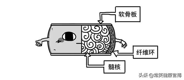 腰椎间盘突出症：干啥啥不行，腰椎间盘突出我最行？