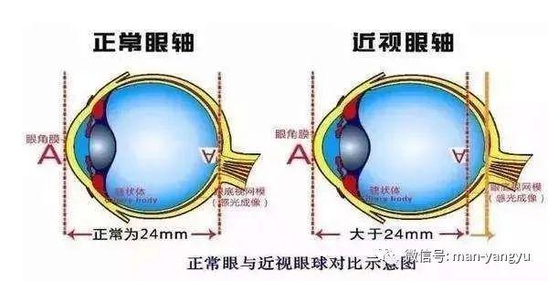 超级宝妈：关注孩子眼健康 减轻网课对眼睛带来的伤害