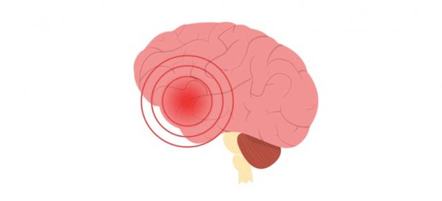 心脑血管病人冬季锻炼别随便，看完这篇再去练