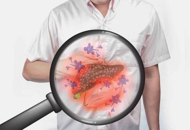 病从口入！医生告诫：4个饮食习惯让你“吃”出癌症，趁早改正