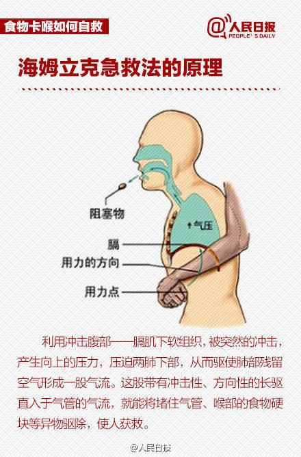 学校|小学生上课误吞下药瓶！危急时刻，这个老师果断出手......太棒了