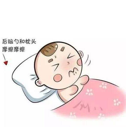 超级宝妈■90%的婴儿有枕秃,正常吗?