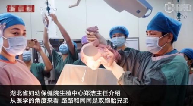 童颜鹿|兄弟俩年龄相差10岁，还是双胞胎？医生亲口证实：确实是这样