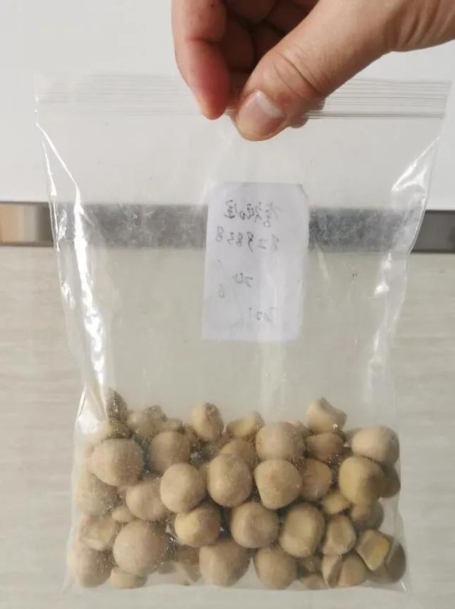 老伯|老伯体内取出100多颗“石头”，这个坏习惯不少人都有