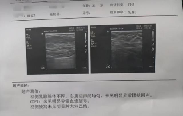 不要再被“钙化”绑架——乳腺结节患者经历