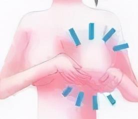 “乳腺增生”怕刮痧，多刮刮就好了