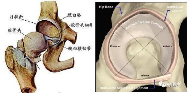 一文读懂髋关节撞击综合征