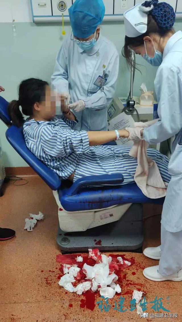 肿物|触目惊心！福建女子脸上顶拳头大肿物30年，接连两次被碰破，满地鲜血