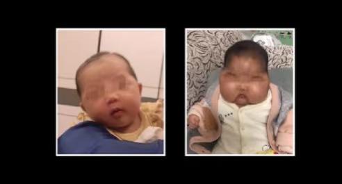 抑菌霜涂出“大脸娃娃”，深圳消委会发布婴幼儿护肤品提示