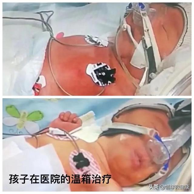 双胞胎先天心脏闭合不全，是如何6个月再造心脏