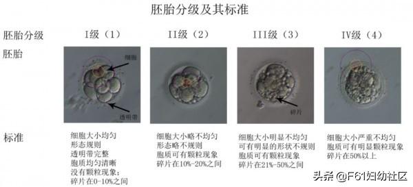 生活矜持点|试管婴儿胚胎评分和胚胎移植、冷冻、丢弃标准