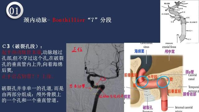 头颈动脉系统相关解剖