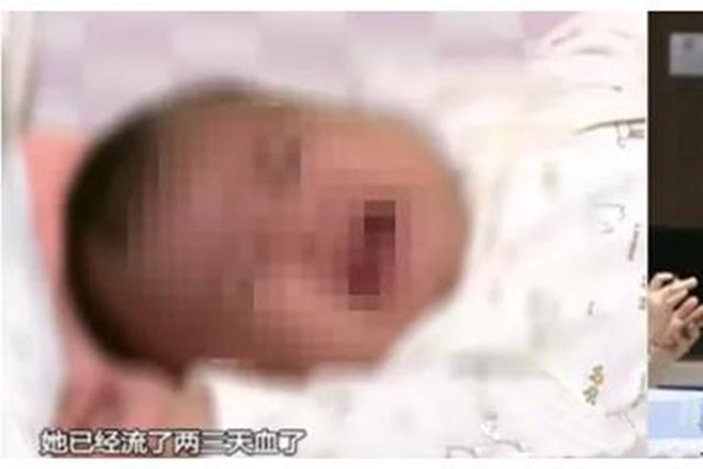 你的育儿经|新生儿也会突发脑出血？或因这个“陋习”所致，宝妈们赶紧自查