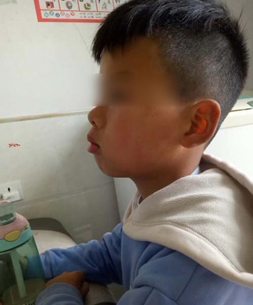 「你的育儿经」孩子越长越像“大猩猩”，妈妈着急送医检查，医生：咋不早点来？