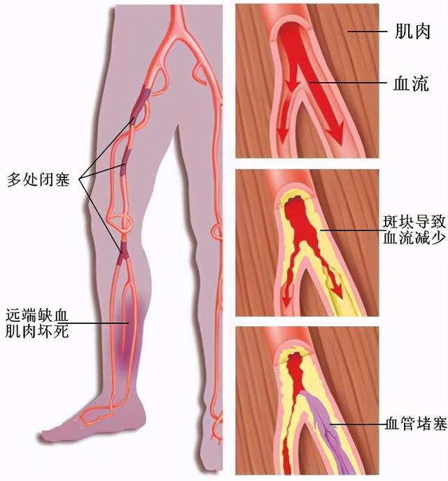 睡前热水泡脚，睡个舒服觉！仅是生活习惯吗？有无益处？请看此文