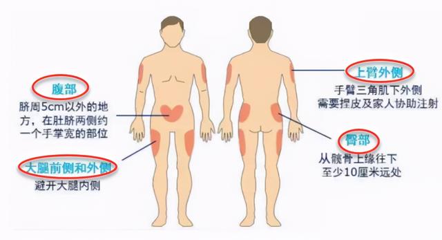 「药物」糖尿病友冬季应如何正确使用胰岛素