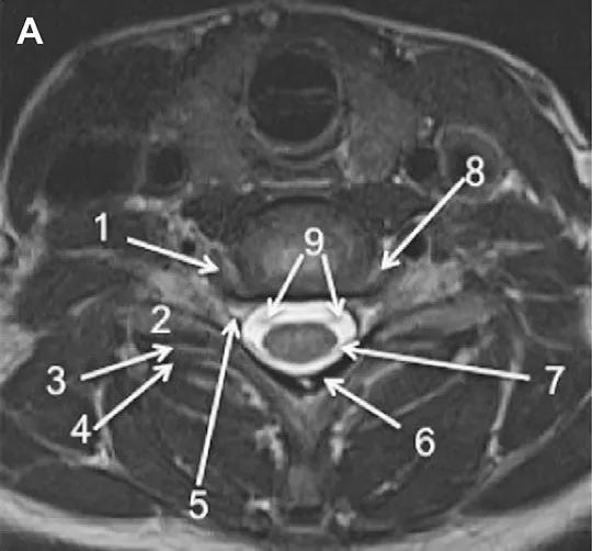 ռ׵ MRI ͼ