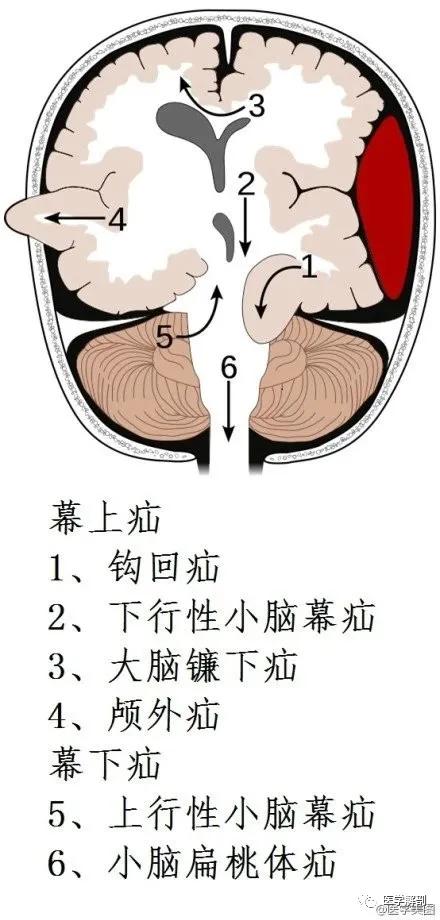 WoW，最全神经系统解剖图来了