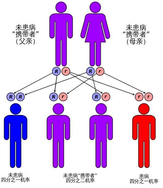 『超级宝妈』父母眼睁睁看着4个月女儿石化：不能动，不能进食，直至不能呼吸
